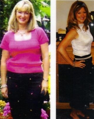 До и после похудения фото