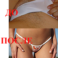 ДоПосле